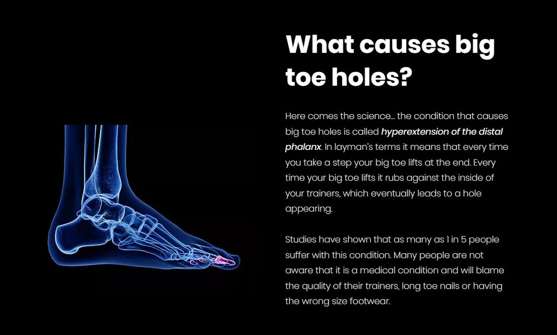 Low-profile black toe protectors reinforce shoes without affecting comfort or fit during wear